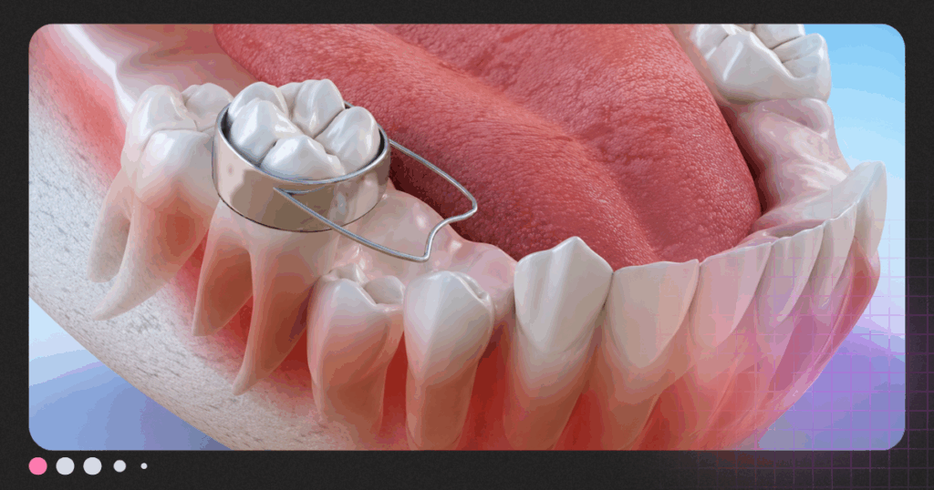 mantenedor dental