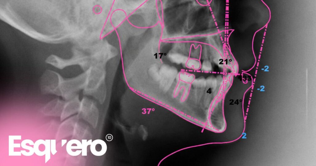 telerradiografía dental